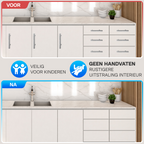 Magnetische Druksnappers 5 Stuks (Incl. Schroeven) | Push to Open | Magneetsnapper | Deursnapper | Voor Keukenkast en Keukenlade